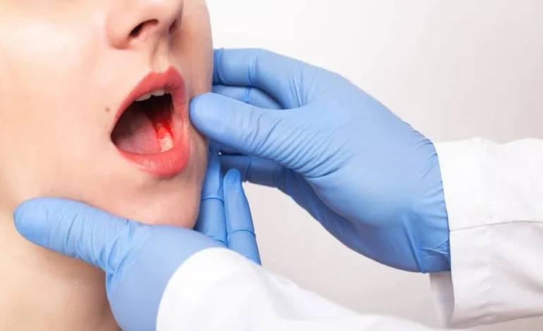 Looking for Oral Cancer Treatment in Mumbai? Here’s What You Need to Know