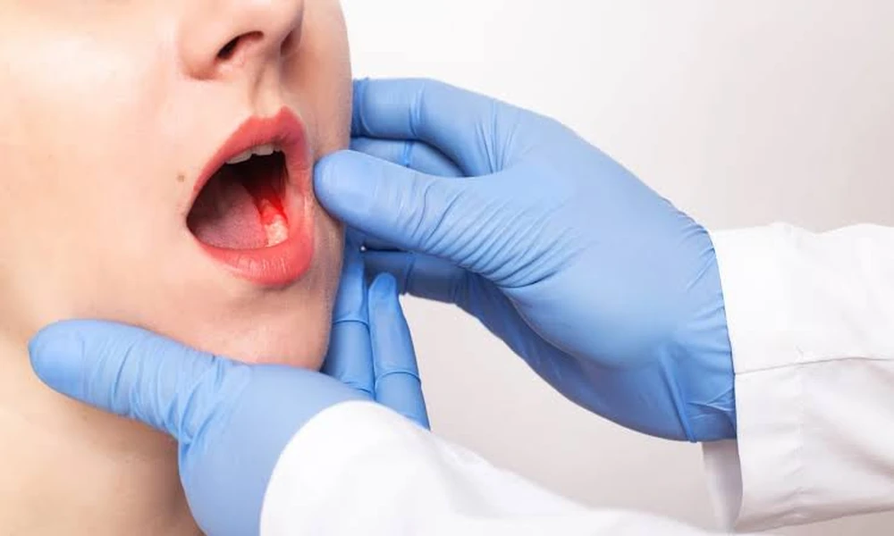 Looking for Oral Cancer Treatment in Mumbai? Here’s What You Need to Know